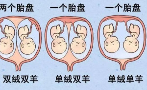 羊胎盘胶囊价格,历史背景、重要事件与当下地位